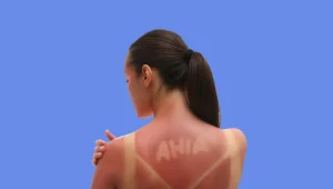 neiparticolari.it Campagna di disease awareness sul melanoma.